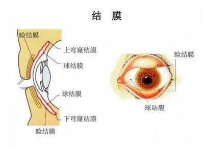 衰老到底是怎么回事呢,人老珠黄,人老珠黄是哪里黄 衰老到底是怎么回事呢,人老珠黄,人老珠黄是哪里黄